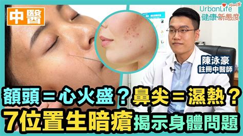 人中生瘡|【暗瘡中醫處理】額頭＝心火盛？鼻尖＝濕熱？7大位。